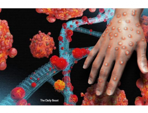 Mengenal Wabah Mpox Sebagai Keadaan Darurat Kesehatan Global